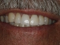 Konig Center for Cosmetic & Comprehensive Dentistry smile photos